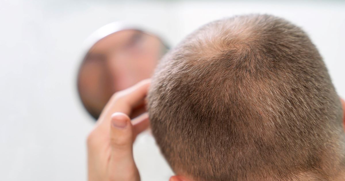 O mercado de saúde capilar acaba de ganhar um reforço tecnológico com foco em precisão e diagnóstico contínuo.