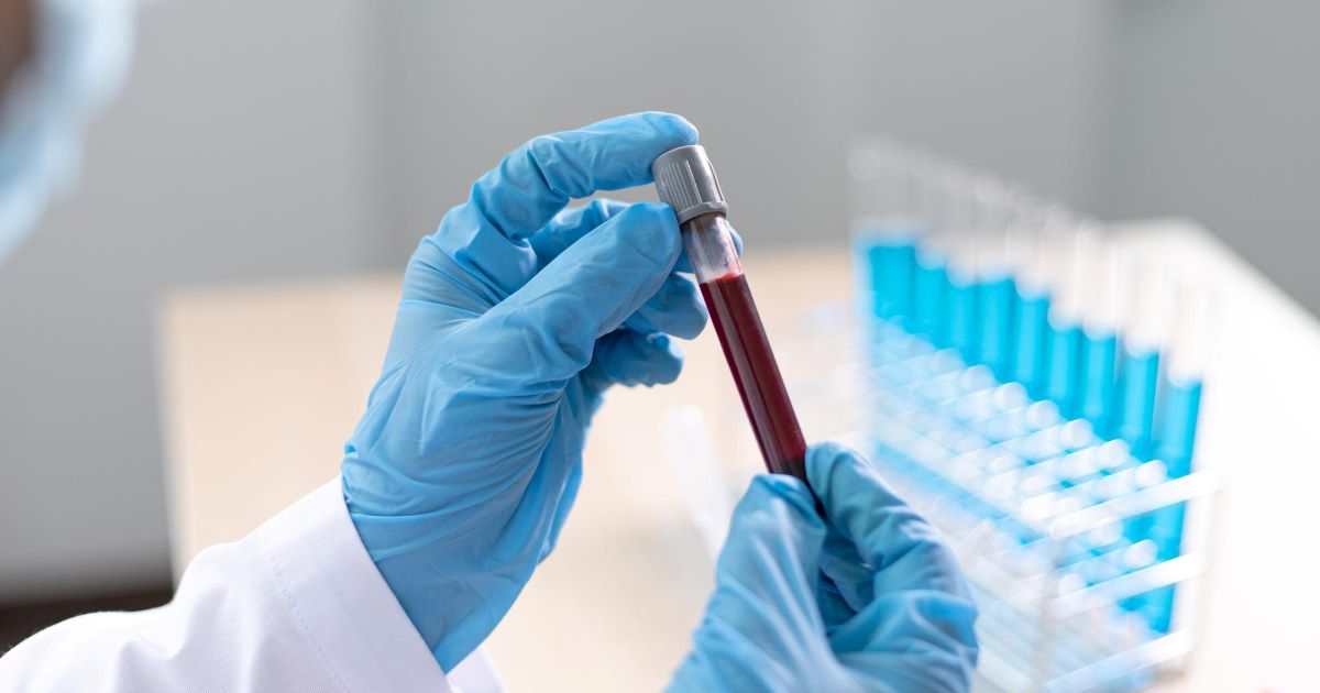 Um homem vivendo com HIV está há mais de seis anos sem apresentar qualquer vestígio detectável do vírus após transplante de células-tronco.