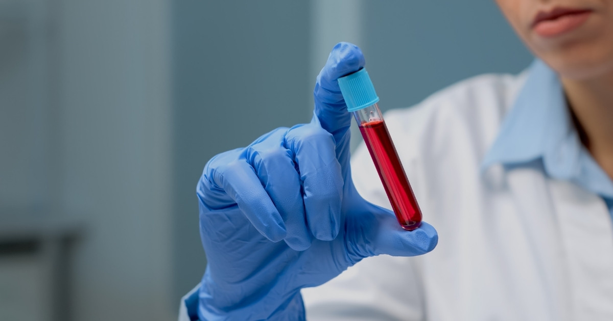 exame-de-sangue-estimar-longevidade