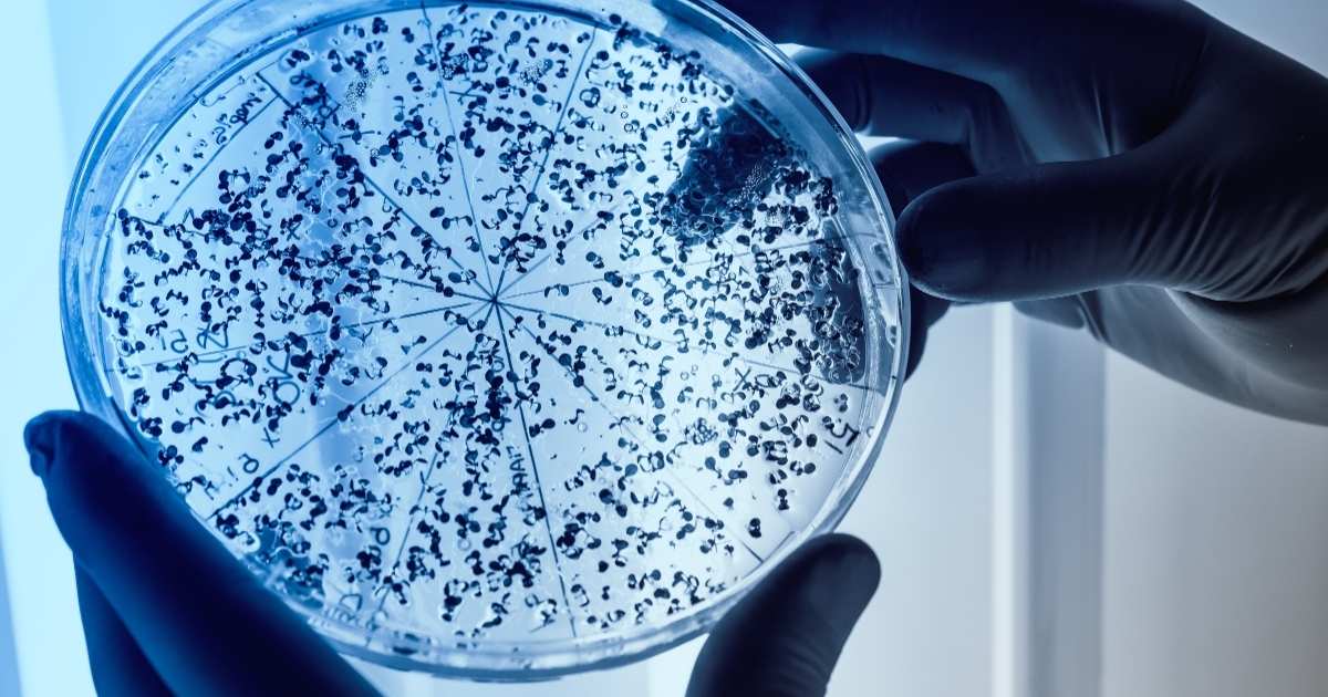 ia-moleculas-ineditas-promissoras-superbacterias