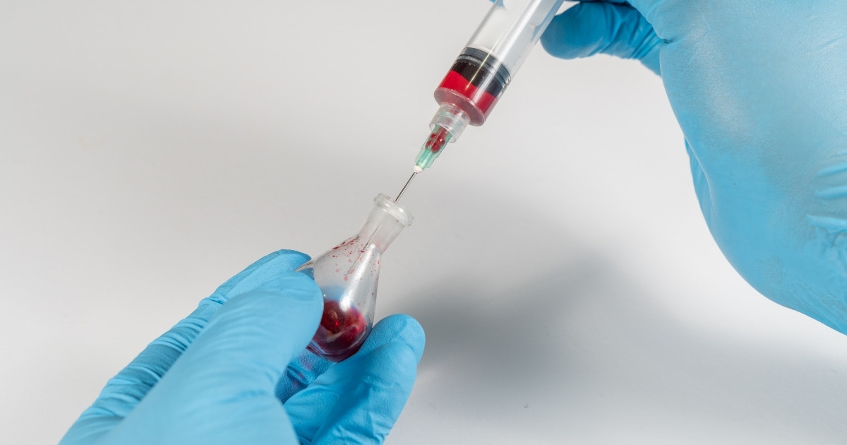 Transplante-com-celulas-irmao-homem-hiv