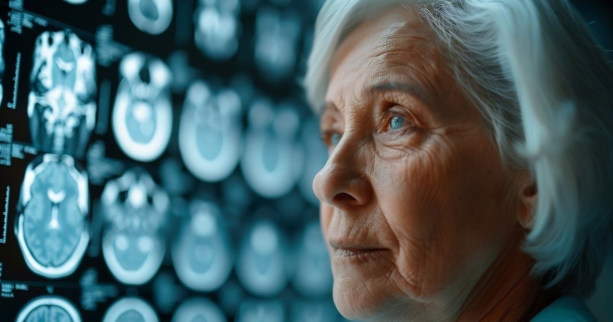 pesquisa-mecanismo-avanco-do-alzheimer